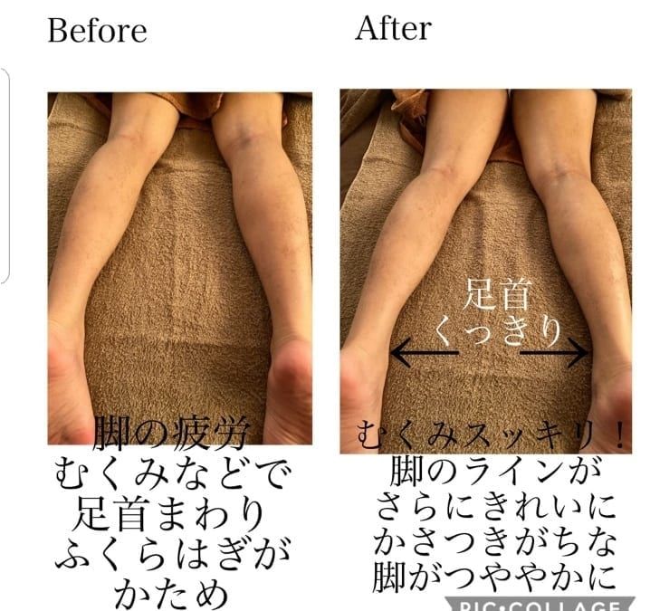 痩身・ボディメイク